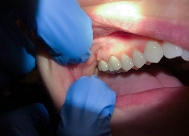 Best Weekend Emergency Dentist in Edgerton, KS